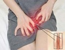 Bị Ngứa Môi Lớn Vùng Kín Và Môi Lớn Nổi Cục, Nổi Hạch