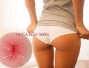 Ngứa hậu môn - Ngứa rát hậu môn: Nguyên nhân và Cách chữa