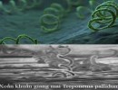 Hỏi đáp về bệnh giang mai - Những thông tin phải biết