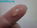Ra Chất Nhầy Màu Trắng Đục Sau Khi Quan Hệ