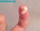 Ra Chất Nhầy Màu Trắng Trong Sau Khi Quan Hệ
