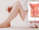 Vết Nứt Ở Kẽ Hậu Môn Có Tự Khỏi, Tự Lành Được Không?