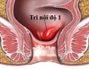 Bệnh Trĩ Nội Độ 1: Hình Ảnh, Biểu Hiện Và Cách Chữa