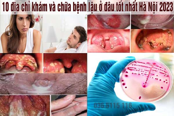 10 địa chỉ khám chữa bệnh lậu ở đâu tốt nhất tại Hà Nội 10 địa chỉ khám chữa bệnh lậu ở đâu tốt nhất tại Hà Nội