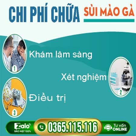 Chi phí chữa sùi mào gà hết bao nhiêu tiền [Hà Nội 2026]