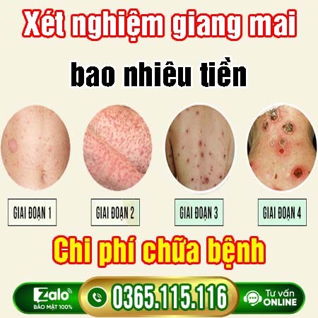 Chi phí xét nghiệm giang mai bao nhiêu tiền [Hà Nội 2026]