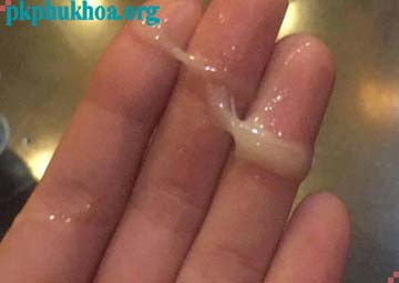 ra chất nhầy màu trắng đục sau khi quan hệ