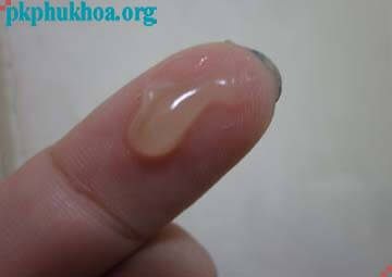 ra chất nhầy màu trắng đục