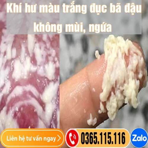 Khí hư màu trắng đục bã đậu không mùi, ngứa và cách điều trị