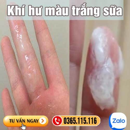 Khí hư màu trắng sữa loãng không mùi không ngứa là bị gì