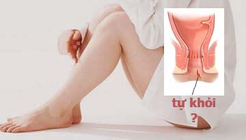 nứt kẽ hậu môn có tự khỏi được không nứt kẽ hậu môn có tự khỏi được không