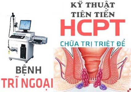 cách chữa bệnh trĩ ngoại cách trị trĩ ngoại