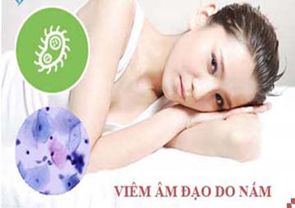 Viêm âm đạo do nấm Viêm âm đạo do nấm