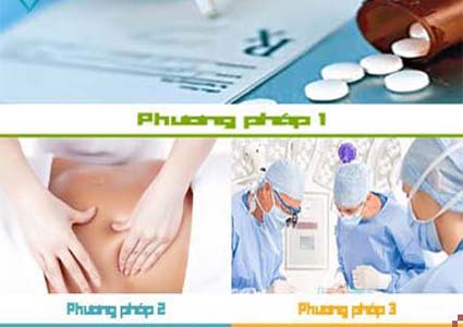 Cách chữa viêm lộ tuyến cổ tử cung Cách chữa viêm lộ tuyến cổ tử cung