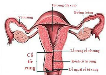 Cổ tử cung