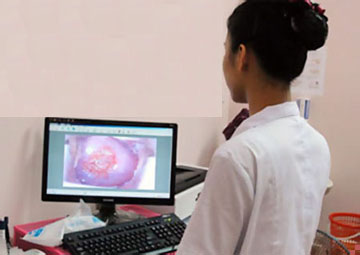 Triệu chứng viêm lộ tuyến cổ tử cung Triệu chứng viêm lộ tuyến cổ tử cung