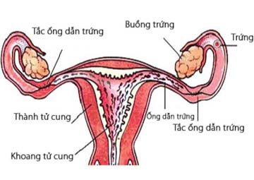 Tắc vòi trứng có kinh nguyệt không? Tắc vòi trứng có kinh nguyệt không