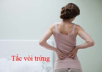 Triệu chứng tắc vòi trứng Triệu chứng tắc vòi trứng