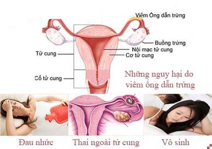 Những tác hại do viêm ống dẫn trứng