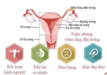 Triệu chứng viêm vòi trứng