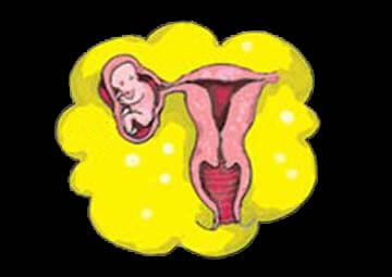 Thai ngoài tử cung Tác hại và ảnh hưởng của 9 bệnh phụ khoa