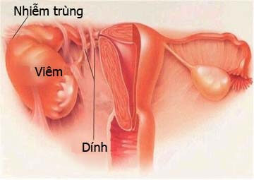 Hình ảnh vùng chậu Hình ảnh vùng chậu