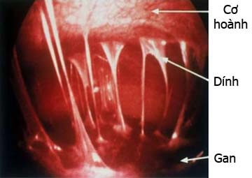 Hình ảnh vùng chậu Hình ảnh vùng chậu
