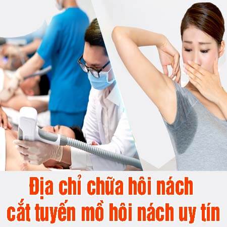 15 địa chỉ chữa hôi nách uy tín cắt tuyến mồ hôi nách tốt tại Hà Nội 15 địa chỉ chữa hôi nách uy tín cắt tuyến mồ hôi nách tốt tại Hà Nội